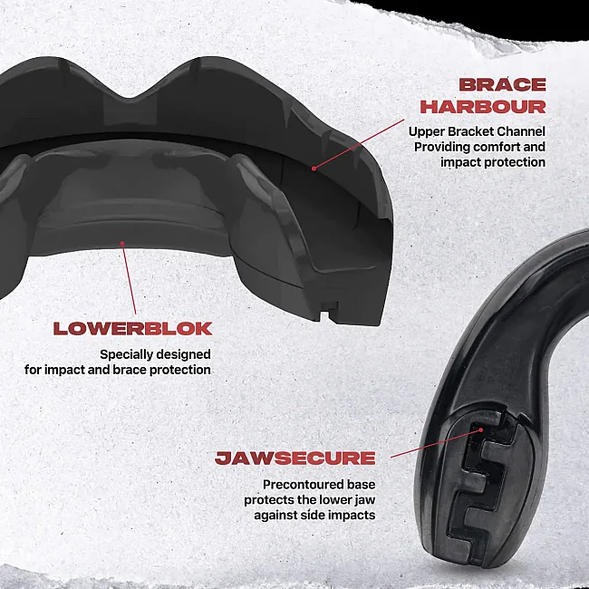 Капа для бокса для брекетов SAFEJAWZ Ortho Series Self-Fit for Braces Black