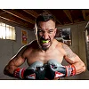 Капа TITLE Boxing Super Shield X2 взрослая (возраст 11+) Yellow