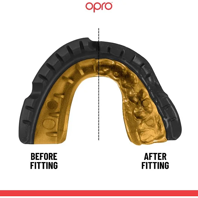 Капа для бокса OPRO GEN5 Gold Braces Black Gold
