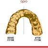 Капа для бокса OPRO Instant Custom-Fit UFC Strike