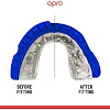 Капа для бокса OPRO GEN5 Gold Braces Dark Blue Pearl