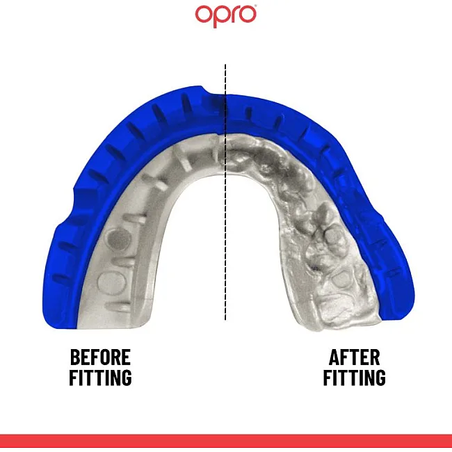Капа для бокса OPRO GEN5 Gold Braces Dark Blue Pearl