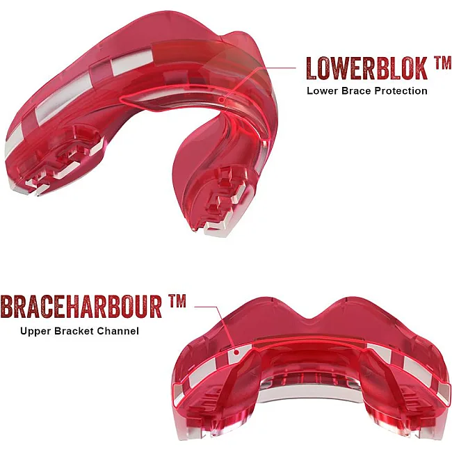 Капа под брекеты SAFEJAWZ Ortho Series Self-Fit Розовая
