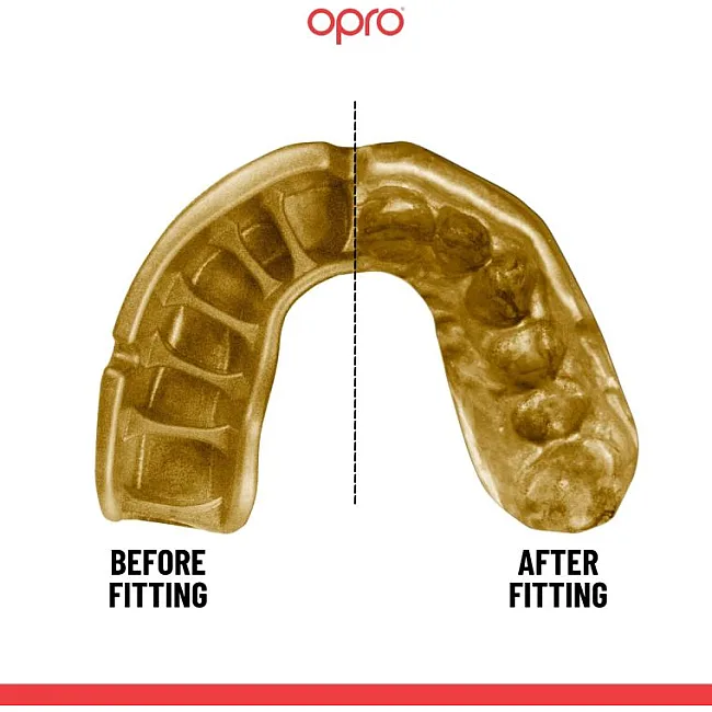 Капа для бокса для детей OPRO Self-fit GEN5 Youth Gold Black Gold