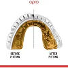 Капа для бокса OPRO GEN5 Gold Braces White Gold