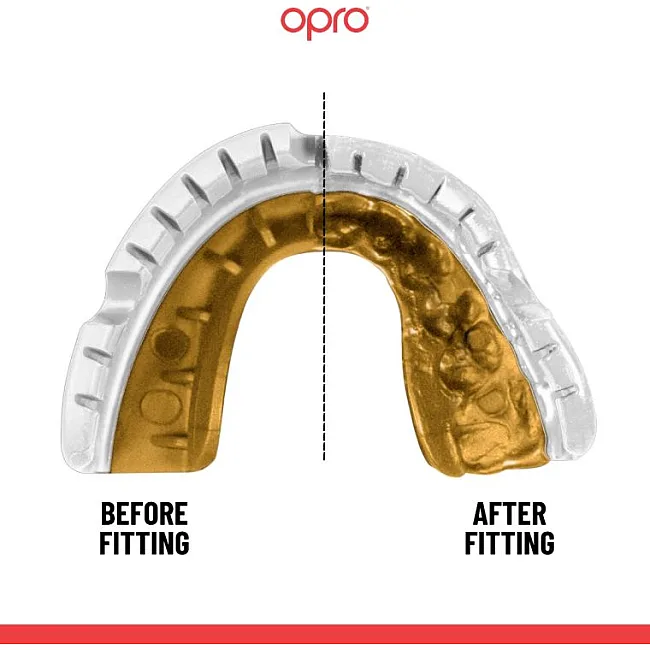 Капа для бокса OPRO GEN5 Gold Braces White Gold