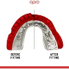 Капа для бокса OPRO GEN5 Gold Braces Red Pearl